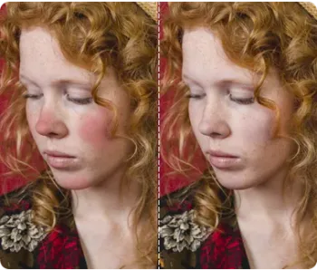 Redness Removal